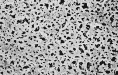 Cellulose acetate syringe filter