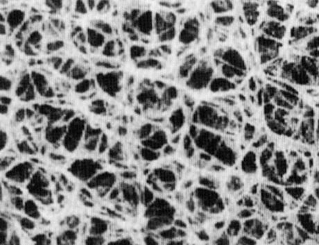 Regenerated cellulose syringe filter